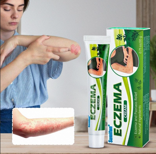 كريم ECZEMA للعناية بالبشرة الجافة والحساسة 20 جم